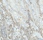 Anti-ACAA2 Rabbit Monoclonal Antibody